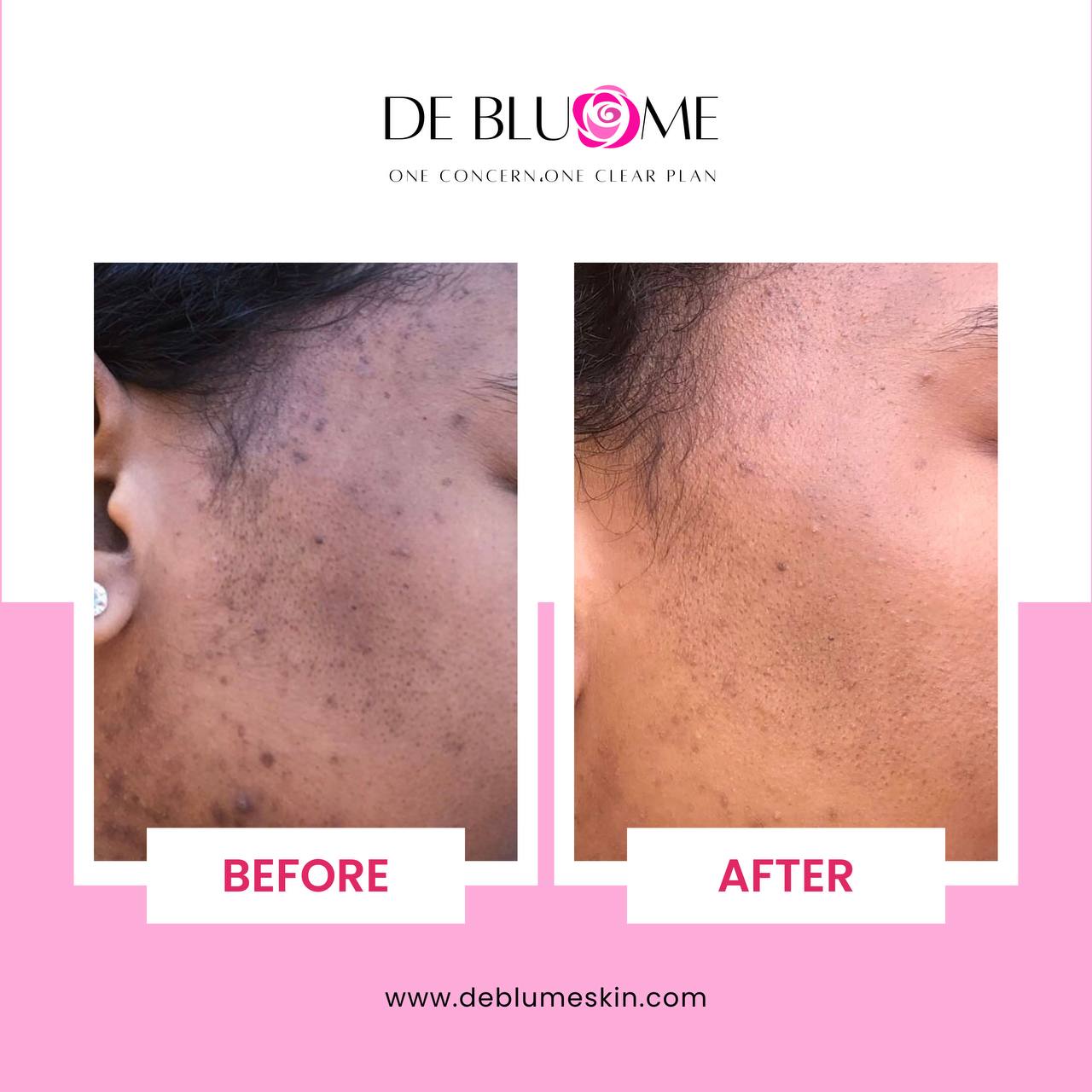 Glow-Up Serum 30 ml