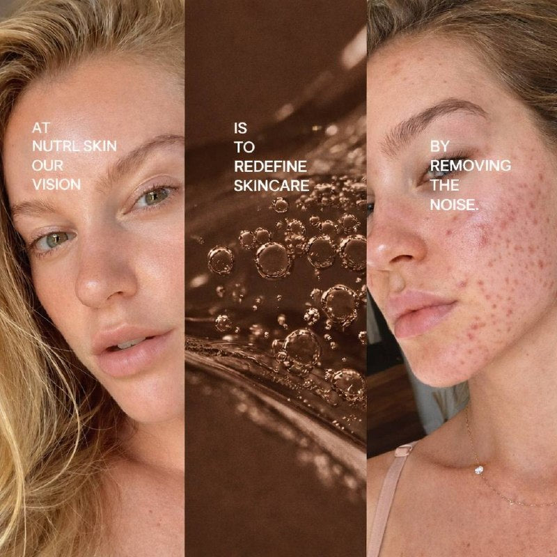 No-Acne Toner 100 ml